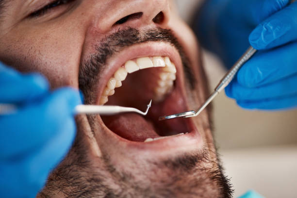 Oral Cancer Screening in Mount Carmel, TN